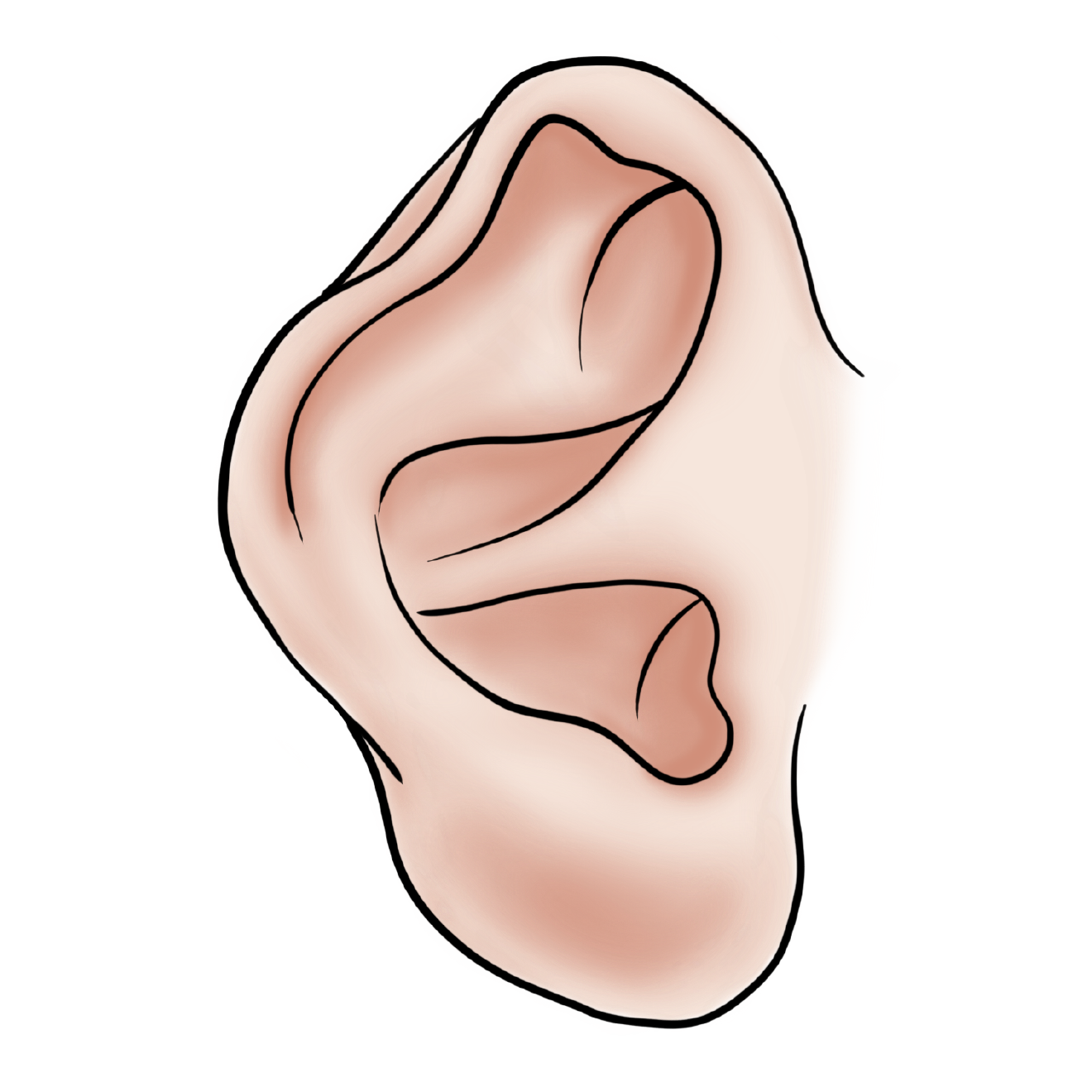 Helical Rim deformity Helical Rim Deformity